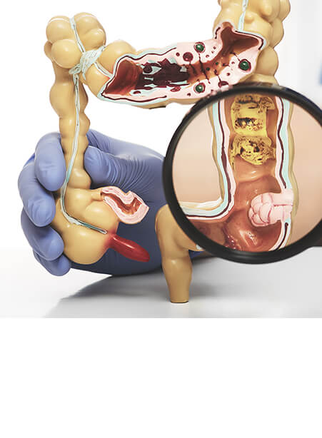 Colorectal Surgeon
