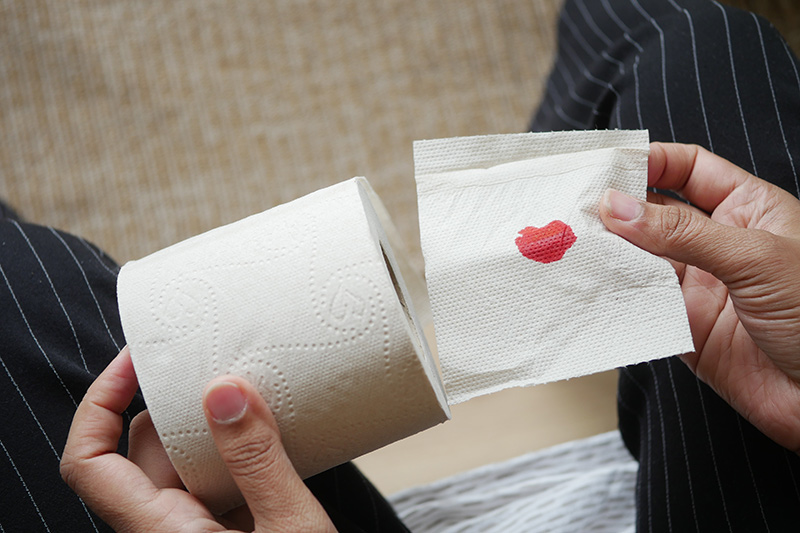 Bright red blood on toilet paper, a possible symptom of bleeding haemorrhoids