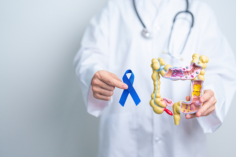 A doctor holding a blue ribbon for Colorectal Cancer Awareness month